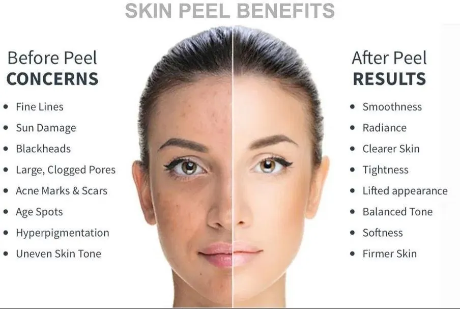 Image Skincare Peels behandeling
